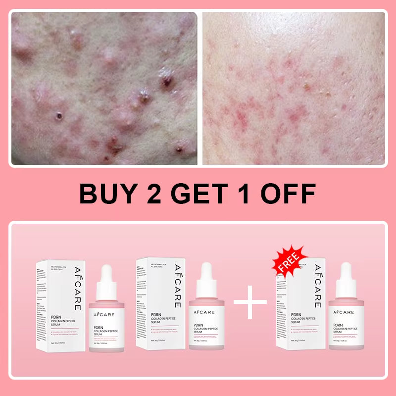 Collagen Peptide Facial Serum Targets Dull Skin Boosts Skin Elasticity Stimulates Skin Renewal Repair Salmon PDRN KOREAN Product