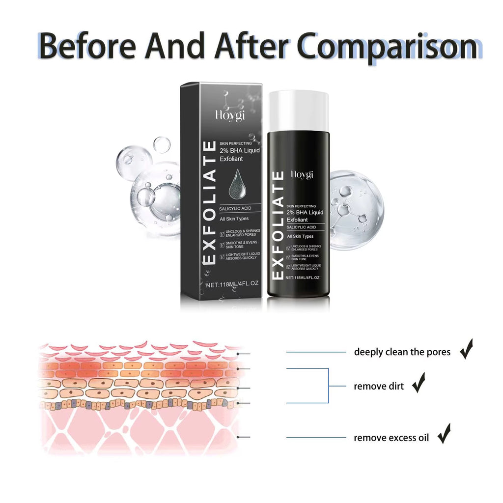 Exfoliant Facial Essence 2% BHA Salicylic Acid Liquid - Pimple Reducing Dark Spot Corrector Pore Minimizing Hydrating Smoothing