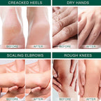 Urea Cream 42%, Foot Cream for Dry Cracked Heels, Urea Cream 42 Percent for Feet, Moisturizing & Exfoliating Foot Cream with 2%