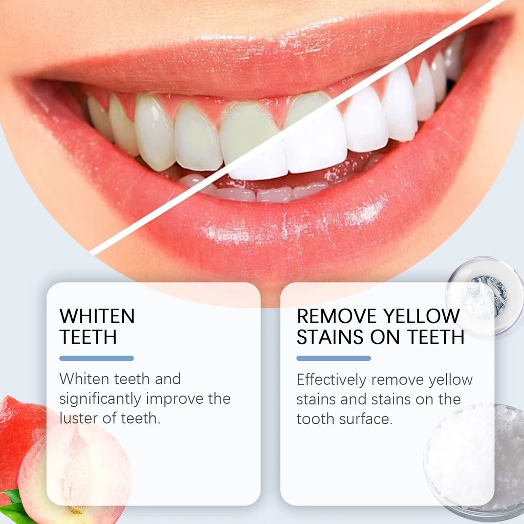 Oralhoe 100g Niacinamide Whitening Toothpaste Brighten Teeth Clean Teeth Stain Mouth Fresh Breath Oral Hygiene Bleach Toothpaste