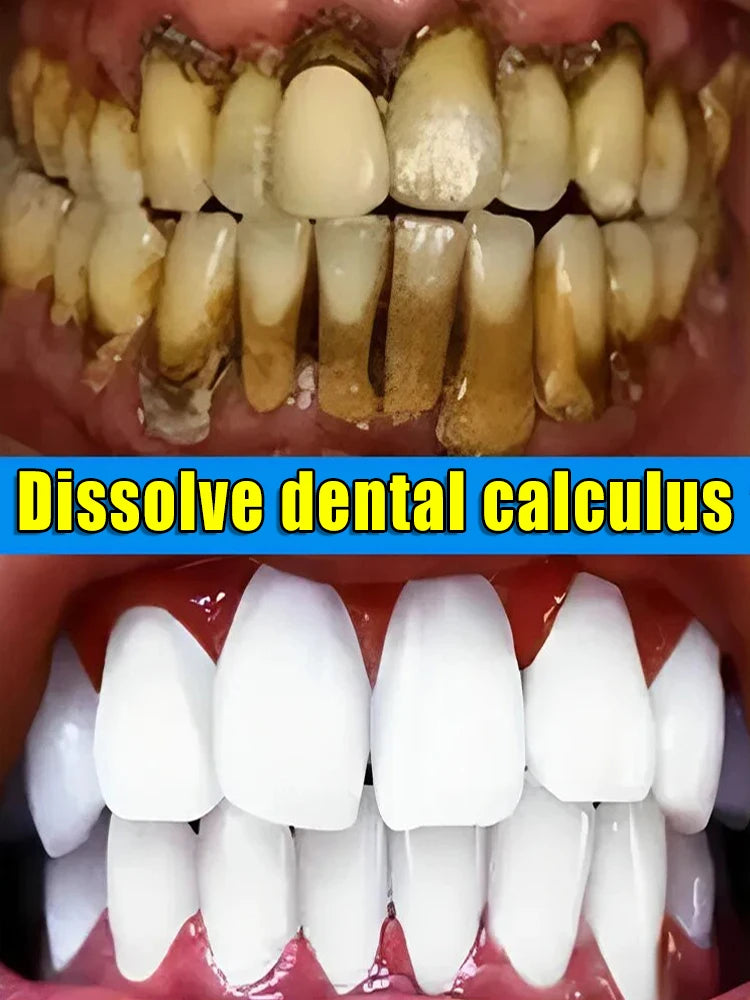 Teeth Whitening Products Tooth Mousse Tooth Stain Oral Gum Care Fresh Breath