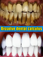 Teeth Whitening Products Tooth Mousse Tooth Stain Oral Gum Care Fresh Breath