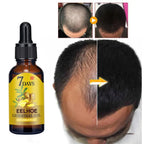 EELHOE 20ml Ginger Hair Growth Oil Strengthening Scalp Nourishing Hair Roots Anti Loss Fuller Care Hairs Essence for Women Men