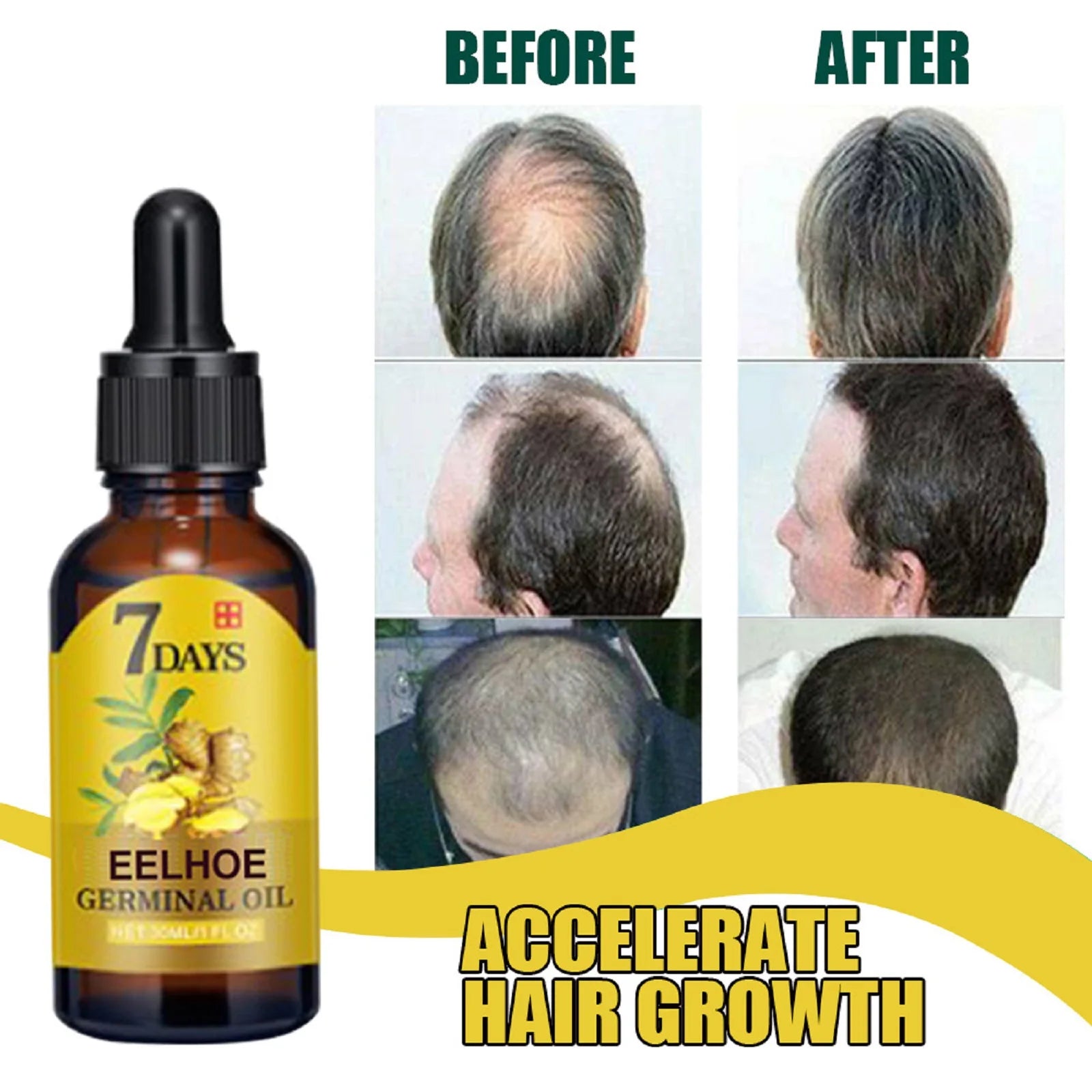 EELHOE 20ml Ginger Hair Growth Oil Strengthening Scalp Nourishing Hair Roots Anti Loss Fuller Care Hairs Essence for Women Men Imagen secundaria del producto