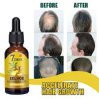 EELHOE 20ml Ginger Hair Growth Oil Strengthening Scalp Nourishing Hair Roots Anti Loss Fuller Care Hairs Essence for Women Men