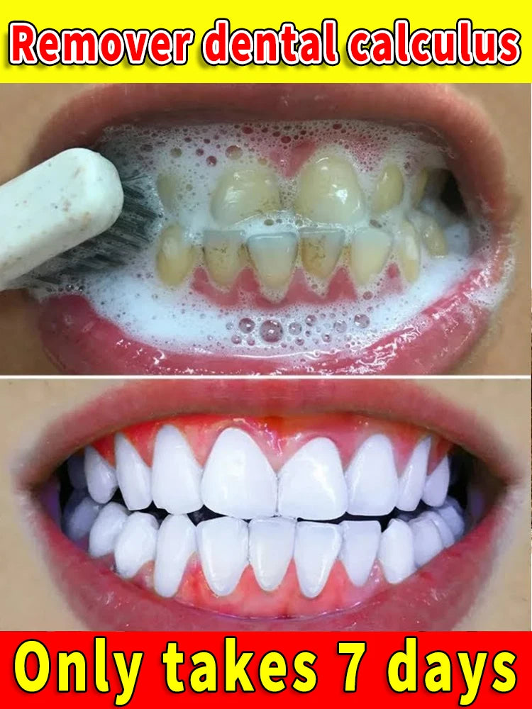 Teeth Whitening Products Tooth Mousse Tooth Stain Oral Gum Care Fresh Breath