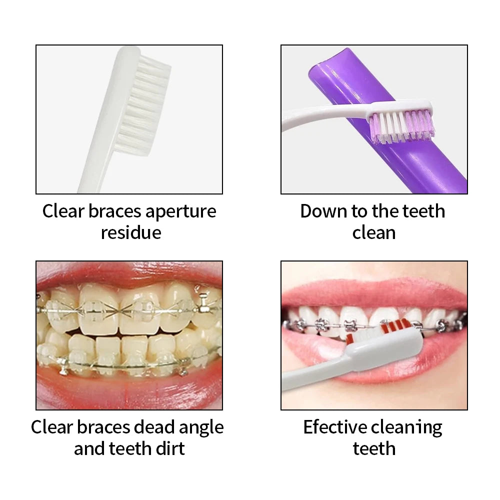 8pcs/set Orthodontic Care Kit Oral Cleaning Teeth Whitening Portable Whitening Tool Suit Interdental Brush Portable