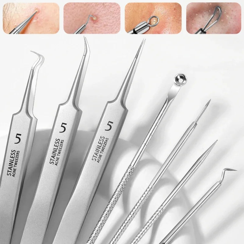 8pcs Professional Skin Care Tools Stainless Steel Pimple Extractors & Needles - for Blackhead Removal, Acne Treatment Imagem principal do produto