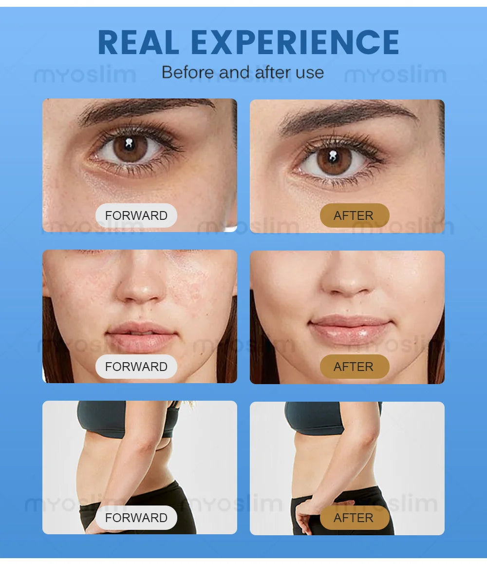 7D ABS Desktop Facial Lifting and Slimming Machine - Home Beauty Device for Wrinkle Removal, Acne Treatment, and Skin Care